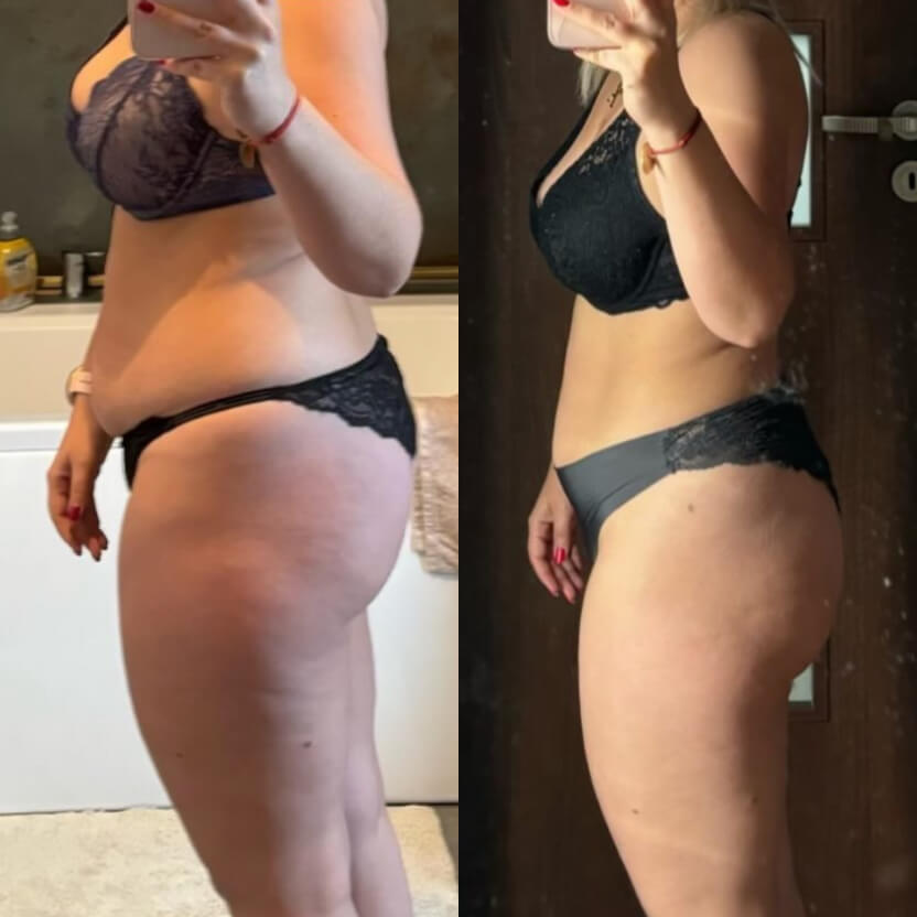 Przemiana Anny, której talia, pośladki i nogi znacząco wyszczuplały.